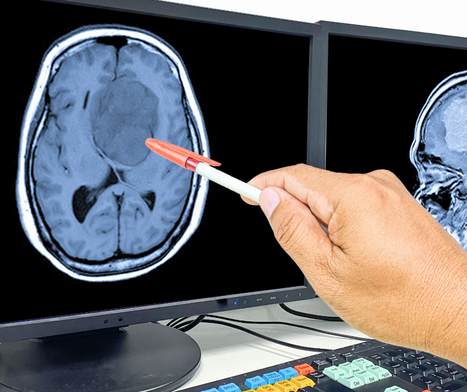 The St. Lucie Cancer Cluster Probe: What the February 2026 Health Reports Actually Say